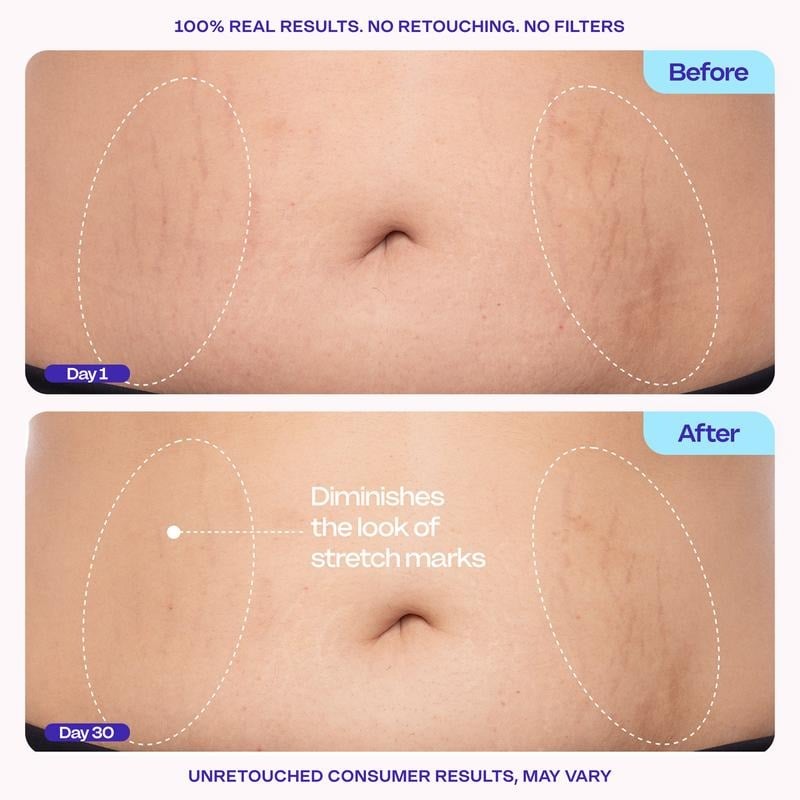 💕Hot sale 49% OFF💖🌸 New! Tighten & Smooth Belly Firming Cream