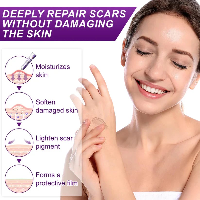 Misspone™ Face & Body Scar Gel – Clinically Proven Formula to Soften, Flatten & Fade Scars from Surgery, Acne, Burns, and Keloids