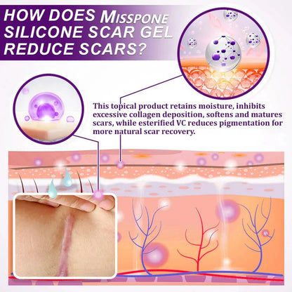 Misspone™ Face & Body Scar Gel – Clinically Proven Formula to Soften, Flatten & Fade Scars from Surgery, Acne, Burns, and Keloids