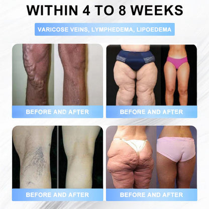 FDA Store | 𝐍𝐚𝐭𝐫𝐚𝐯𝐨𝐫™ 𝐒𝐥𝐢𝐦 & Firm 𝑁ano 𝑀icroneedle 𝑃atch with Collagen, Turmeric & Matrixyl 3000丨Obesity, Cardiovascular Disease, Diabetes, Sleep Apnea, Joint Problems and More