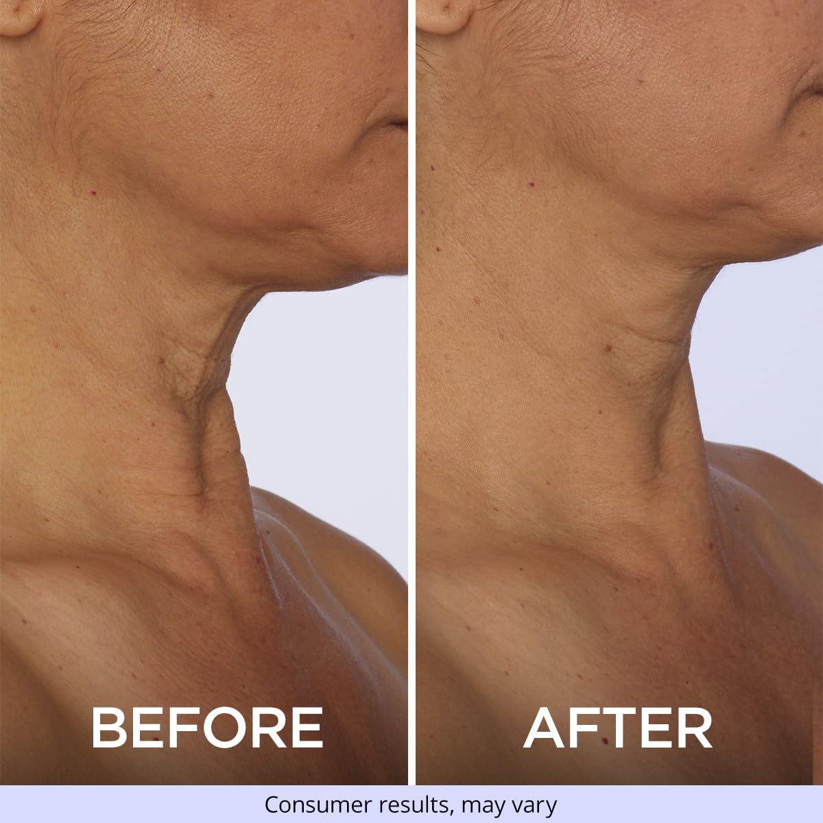 goPure Tighten and Lift Neck Cream- Clinically Tested