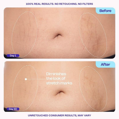 💕Hot sale 49% OFF💖🌸 New! Tighten & Smooth Belly Firming Cream