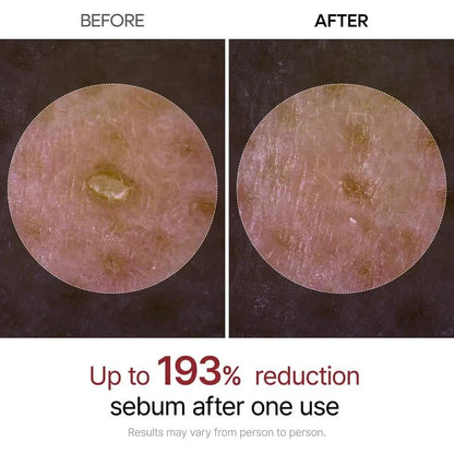 🏆Flash Sale⚡ 50K+ SOLD! Almost Gone-💥🔥Peel Shot Glow Rice Ampoule Duo